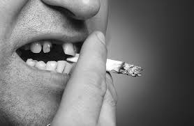 Smoking can cause Implant Failure